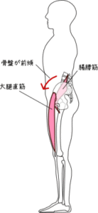 膝痛と腰痛の関係